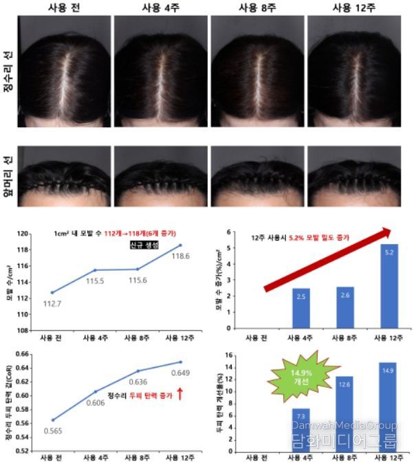 모발 밀도와 두피 탄력 개선